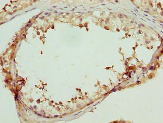 LRRC18 Antibody