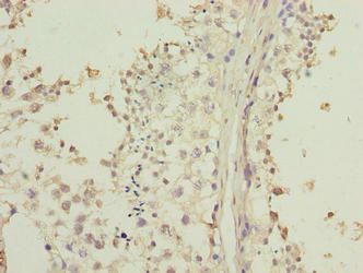 LRRC20 Antibody