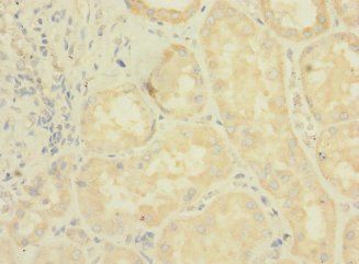 LRRC31 Antibody