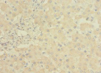 LRRC31 Antibody