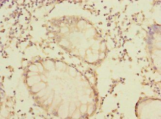 LRRC32 Antibody