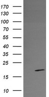 LRRC39 Antibody