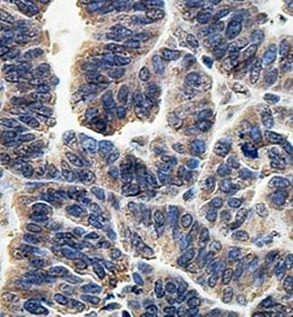 LRRC46 Rabbit Polyclonal Antibody