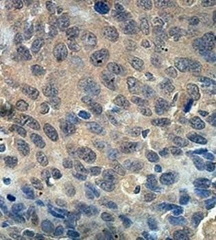 LRRC48 Rabbit Polyclonal Antibody