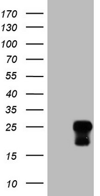 LRRTM1 Antibody