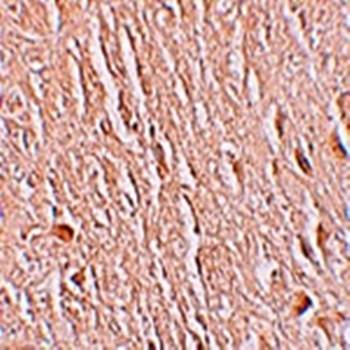 LRRTM3 Antibody