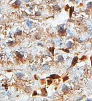 LSM6 Rabbit Polyclonal Antibody