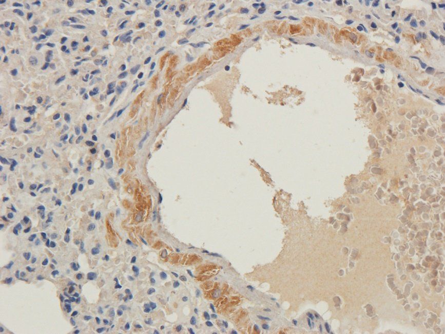 LTBP4 antibody