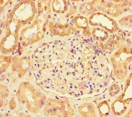 LHB Antibody