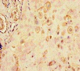 LHB Antibody