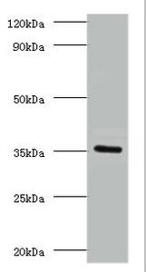 BRCC3 Antibody