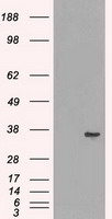 KARS Antibody