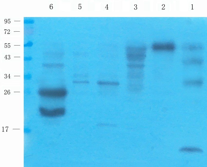 LYVE1 Rabbit Polyclonal Antibody