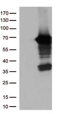 LZTS1 Antibody