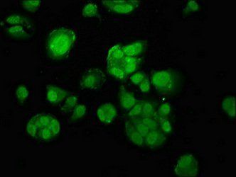 MACC1 Antibody