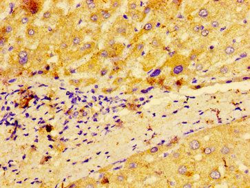 MACC1 Antibody