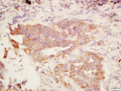 MAdCAM1 Rabbit Polyclonal Antibody