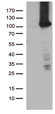 AGPAT9 Antibody