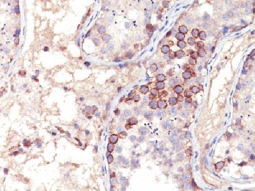 MAGEA1 Antibody