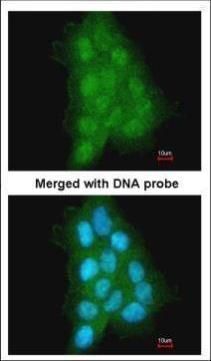 MAGEA11 Rabbit Polyclonal Antibody