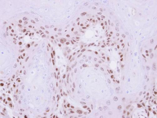 MAGEA11 Rabbit Polyclonal Antibody