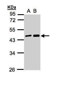 MAGEA11 Rabbit Polyclonal Antibody