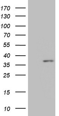 MALT1 Antibody