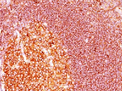 MALT1 Antibody