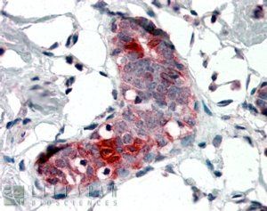 Goat anti-Mammaglobin A / SCGB2A2 Antibody