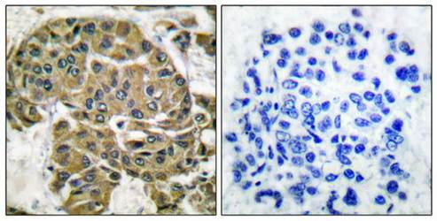 Mammaglobin B Antibody