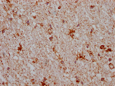 MAOB Antibody