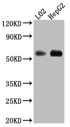 MAOB Antibody
