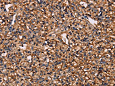 MAP1LC3C Antibody