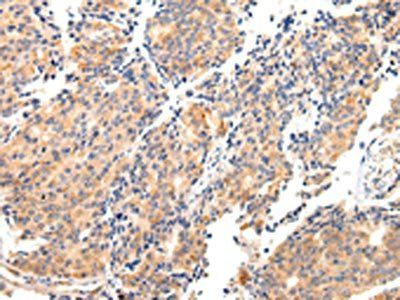 MAP2 Antibody