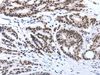 Map2 Antibody