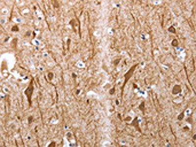 Map2 Antibody
