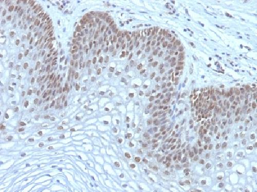 MAP3K1 Antibody