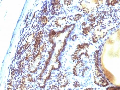 MAP3K1 Antibody