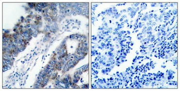 MAP3K5 Antibody