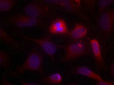 MAP3K5 Antibody