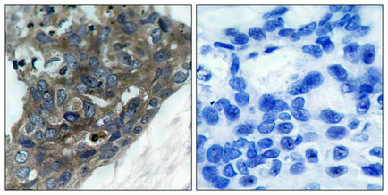 MAP3K5 Antibody