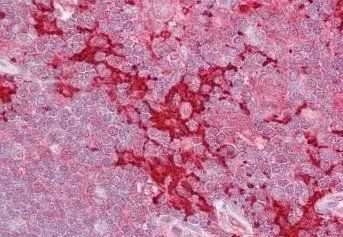 HPK1/MAP4K1 Antibody