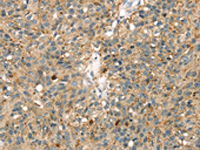 MAPK12 Antibody