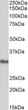 MAPRE3 Antibody