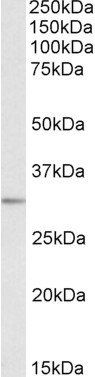 MAPRE3 Antibody
