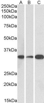 MAPRE3 (aa151-164) Antibody