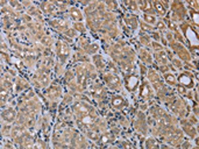 MAPRE3 Antibody