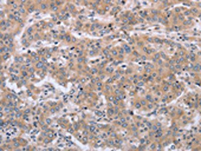 MAPRE3 Antibody