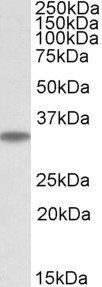 MAPRE3 (aa151-164) Antibody
