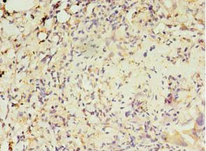 MAS1L Antibody